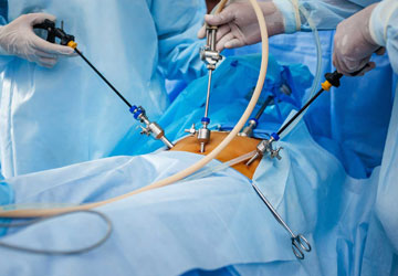 Laparoscopic Surgery Specilist in Kolhapur